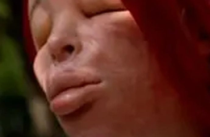 الدكتور الطراونة يحذر من “هوس التجميل” والسقوط في فخ الإعلانات المضللة